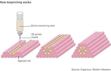 Bioprinting